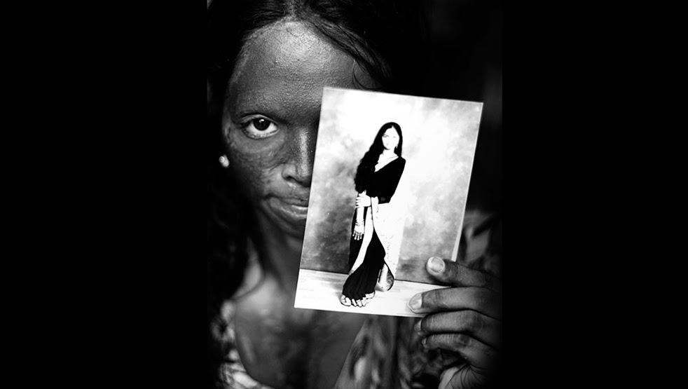 Laxmi, Face of the Campaign, Photographer Ravi Choudhury